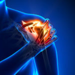 Should pain illustration
